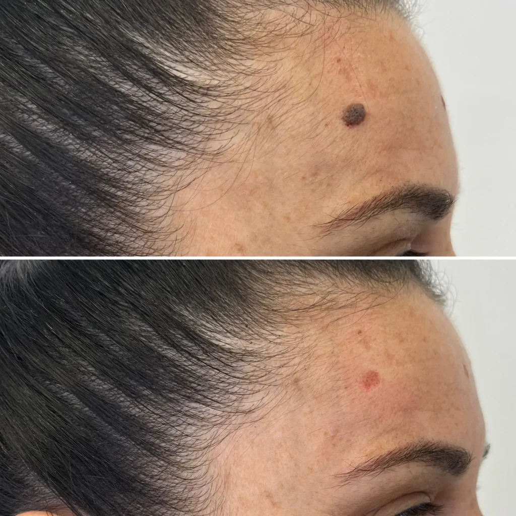 Dermaplax Almería