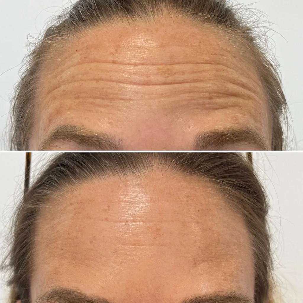 Neuromodulación Almería