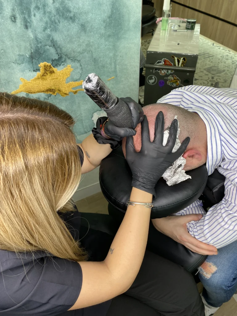 tricopigmentacion capilar roquetas