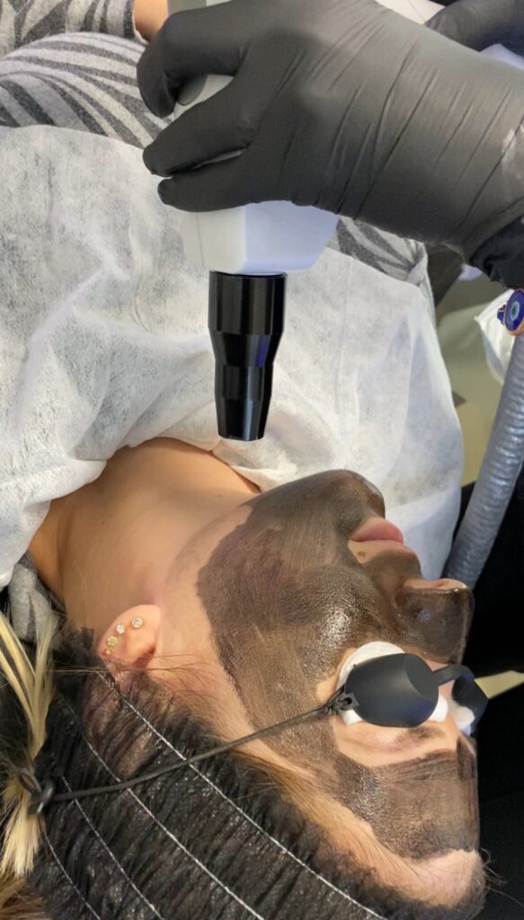 carbon activo almeria