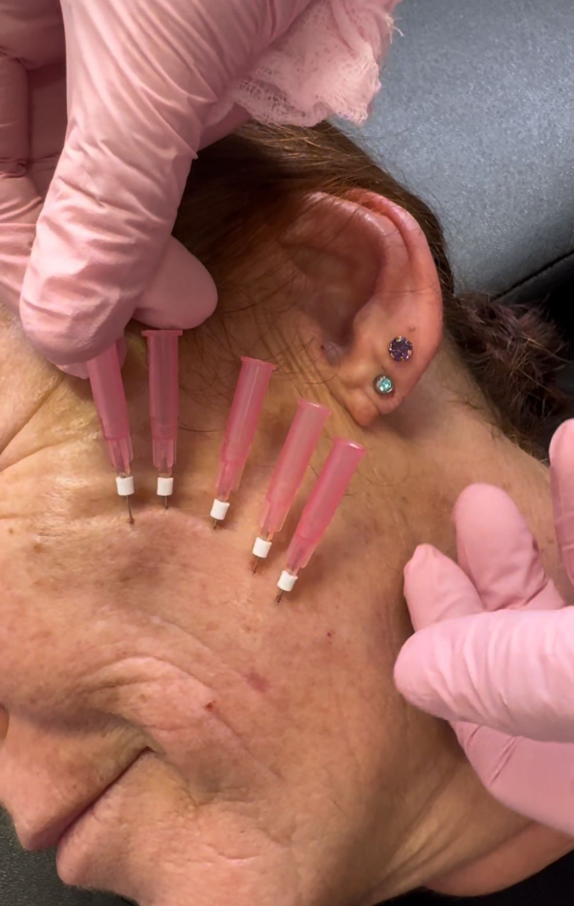 Hilos Tensores Almeria