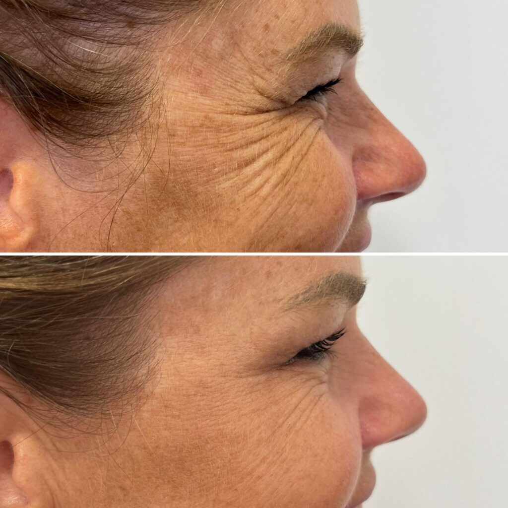 neuromodulacion almeria