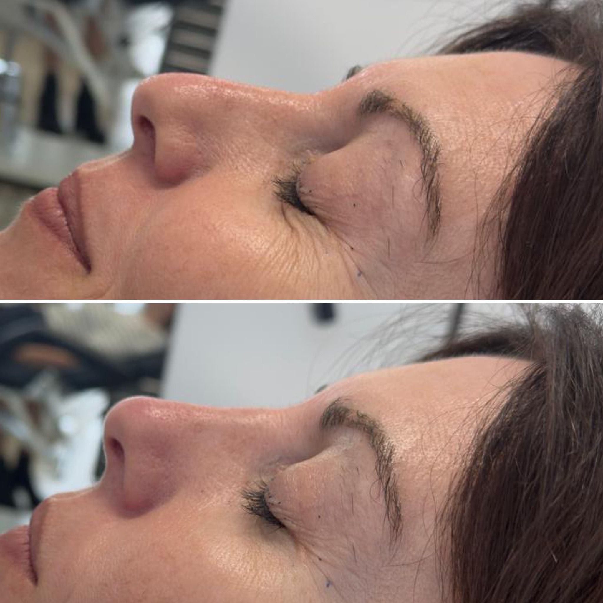 Rinomodelacion en roquetas de mar