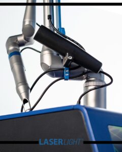 eliminacion-tatuaje-almeria-hunter-master-pro-3